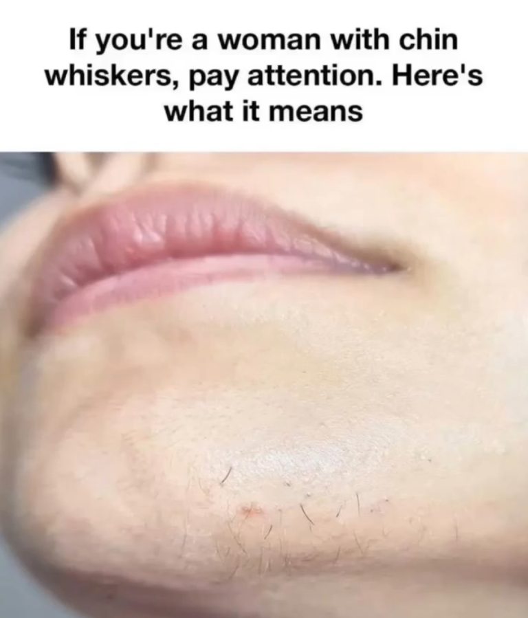 CHIN