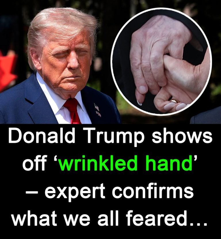 WRINKLED