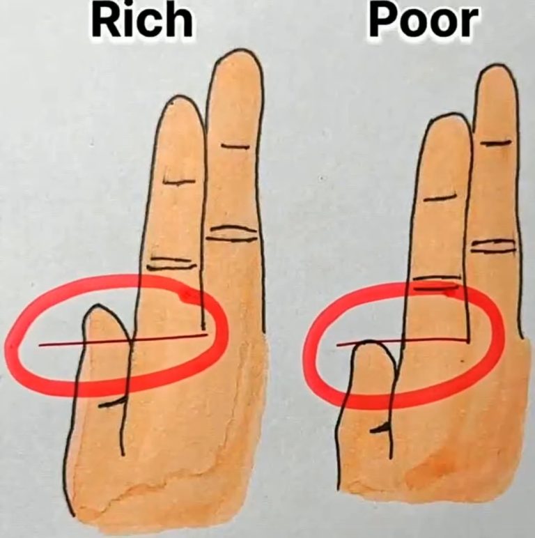 finger