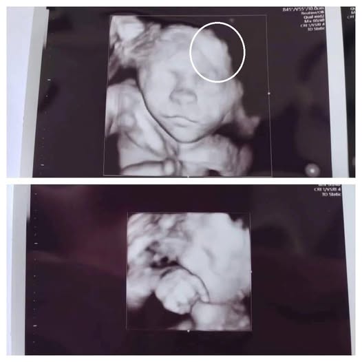 Mother is scared to see her daughter’s ultrasound; image showed the… See more