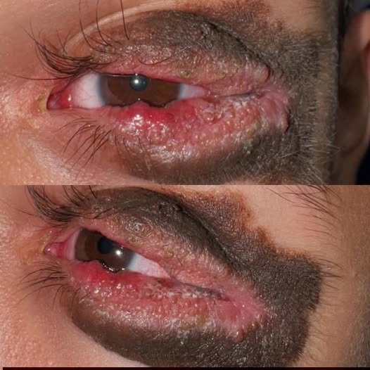 Stop Sleeping With Your Phone: What Everyone Needs to Know – story